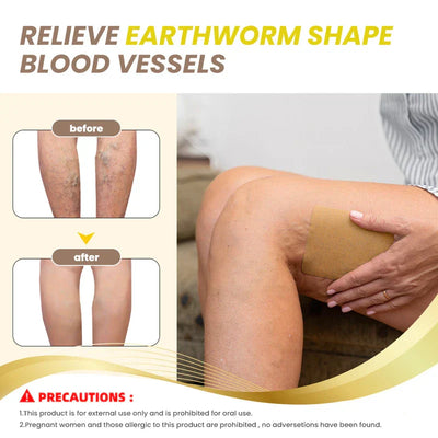 Varicose Vein Support Patches